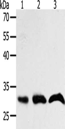 Gel: 10%SDS-PAGE, Lysate: 40 ug, Lane 1-3: Hela cells, A549 cells, lncap cells, Primary antibody: CSB-PA440611(PTGES2 Antibody) at dilution 1/400, Secondary antibody: Goat anti rabbit IgG at 1/8000 dilution, Exposure time: 20 seconds