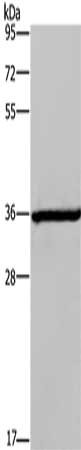 Gel: 6%SDS-PAGE, Lysate: 50 ug, Lane: Mouse brain tissue, Primary antibody: CSB-PA440740(DIO2 Antibody) at dilution 1/200, Secondary antibody: Goat anti rabbit IgG at 1/8000 dilution, Exposure time: 40 seconds
