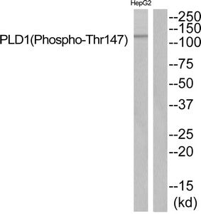 Western blot analysis of extracts from HepG2 cells using PLD1 (Phospho-Thr147) Antibody.The lane on the right is treated with the antigen-specific peptide.