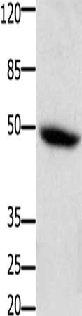 Gel: 10+12%SDS-PAGE, Lysate: 30 ug, Lane: Mouse heart tissue, Primary antibody: CSB-PA441042(CSF2RA Antibody) at dilution 1/400, Secondary antibody: Goat anti rabbit IgG at 1/8000 dilution, Exposure time: 5 minutes