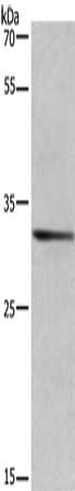 Gel: 8%SDS-PAGE, Lysate: 40 ug, Lane: Human brain malignant gliomn tissue, Primary antibody: CSB-PA441346(AREG Antibody) at dilution 1/363, Secondary antibody: Goat anti rabbit IgG at 1/8000 dilution, Exposure time: 15 seconds