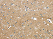 The image on the left is immunohistochemistry of paraffin-embedded Human brain tissue using CSB-PA442448(WASF2 Antibody) at dilution 1/25, on the right is treated with synthetic peptide. (Original magnification: ×200)