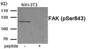 Western blot analysis of extracts from 3T3 cells treated with PMA using Phospho-FAK (Ser843) antibody.The lane on the right is treated with the antigen-specific peptide.