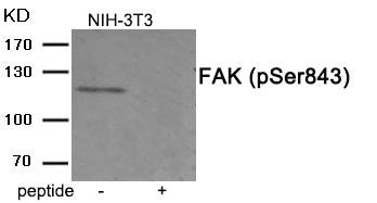 Western blot analysis of extracts from 3T3 cells treated with PMA using Phospho-FAK (Ser843) antibody.The lane on the right is treated with the antigen-specific peptide.