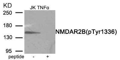 Western blot analysis of extracts from Jurkat cells treated with TNF using Phospho-NMDAR2B (Tyr1336) antibody.The lane on the right is treated with the antigen-specific peptide.
