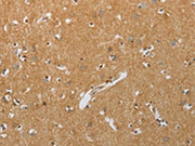 The image on the left is immunohistochemistry of paraffin-embedded Human brain tissue using CSB-PA442874(RHEB Antibody) at dilution 1/25, on the right is treated with synthetic peptide. (Original magnification: ×200)