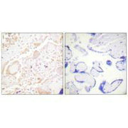 Immunohistochemistry analysis of paraffin-embedded human placenta tissue using GATA3 antibody.