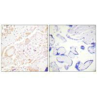 Immunohistochemistry analysis of paraffin-embedded human placenta tissue using GATA3 antibody.