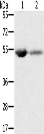 Gel: 8%SDS-PAGE, Lysate: 40 ug, Lane 1-2: Human plasma, Human placenta tissue, Primary antibody: CSB-PA442952(SLC13A3 Antibody) at dilution 1/200, Secondary antibody: Goat anti rabbit IgG at 1/8000 dilution, Exposure time: 2 minutes