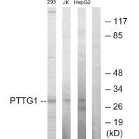 Western blot analysis of extracts from 293 cells, Jurkat cells and HepG2 cells, using PTTG1 antibody.