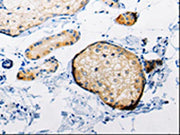 The image on the left is immunohistochemistry of paraffin-embedded Human skin tissue using CSB-PA443132(RAB6A Antibody) at dilution 1/25, on the right is treated with synthetic peptide. (Original magnification: ×200)