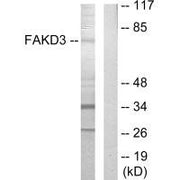Western blot analysis of extracts from HepG2 cells, using FAKD3 antibody.