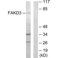 Western blot analysis of extracts from HepG2 cells, using FAKD3 antibody.