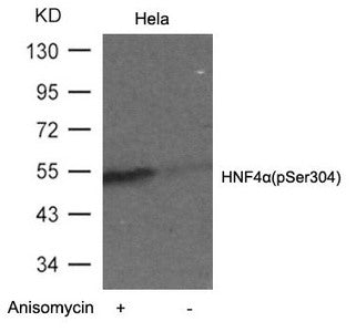 Western blot analysis of extracts from Hela cells untreated or treated with Anisomyclin using HNF4a(Phospho-Ser304) Antibody.
