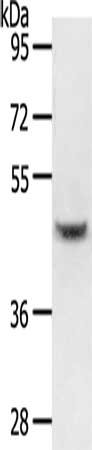 Gel: 10%SDS-PAGE, Lysate: 40 ug, Lane: Human liver cancer tissue, Primary antibody: CSB-PA443773(HNF1B Antibody) at dilution 1/900, Secondary antibody: Goat anti rabbit IgG at 1/8000 dilution, Exposure time: 1 minute