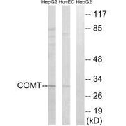 Western blot analysis of extracts from HepG2 cells and HUVEC cells, using COMT antibody.