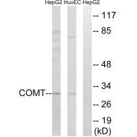Western blot analysis of extracts from HepG2 cells and HUVEC cells, using COMT antibody.