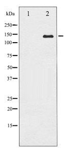 Western blot analysis of Calcium Sensing Receptor expression in LOVO whole cell lysates,The lane on the left is treated with the antigen-specific peptide.