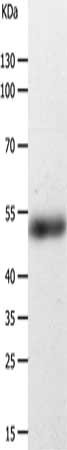 Gel: 10%SDS-PAGE, Lysate: 40 ug, Lane: Human fetal kidney tissue, Primary antibody: CSB-PA444421(CFLAR Antibody) at dilution 1/200, Secondary antibody: Goat anti rabbit IgG at 1/8000 dilution, Exposure time: 30 seconds