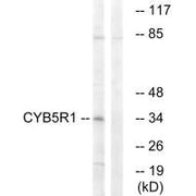 Western blot analysis of extracts from RAW264.7 cells, using CYB5R1 antibody.