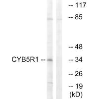 Western blot analysis of extracts from RAW264.7 cells, using CYB5R1 antibody.