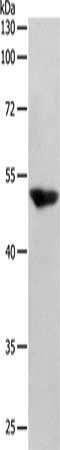 Gel: 10%SDS-PAGE, Lysate: 40 ug, Lane: 293T cells, Primary antibody: CSB-PA445353(SERPINF1 Antibody) at dilution 1/150, Secondary antibody: Goat anti rabbit IgG at 1/8000 dilution, Exposure time: 1 minute