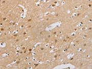 The image on the left is immunohistochemistry of paraffin-embedded Human brain tissue using CSB-PA445592(CDKN2A Antibody) at dilution 1/60, on the right is treated with synthetic peptide. (Original magnification: ×200)