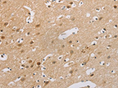 The image on the left is immunohistochemistry of paraffin-embedded Human brain tissue using CSB-PA445592(CDKN2A Antibody) at dilution 1/60, on the right is treated with synthetic peptide. (Original magnification: ×200)