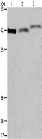 Gel: 6%SDS-PAGE, Lysate: 40 ug, Lane 1-3: Hela cells, mouse heart tissue, Mouse stomach tissue, Primary antibody: CSB-PA445707(ARNTL Antibody) at dilution 1/300, Secondary antibody: Goat anti rabbit IgG at 1/8000 dilution, Exposure time: 1 minute