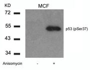 Western blot analysis of extracts from MCF cells untreated or treated with Anisomycin using p53(Phospho-Ser37) Antibody.