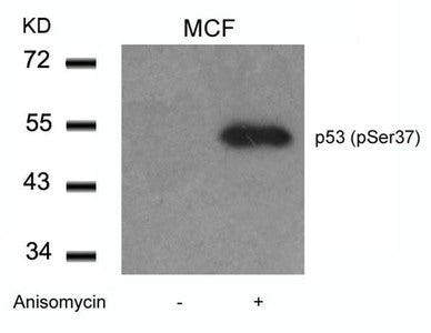 Western blot analysis of extracts from MCF cells untreated or treated with Anisomycin using p53(Phospho-Ser37) Antibody.