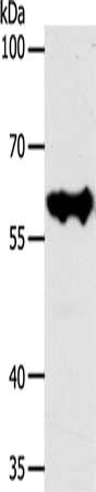 Gel: 8%SDS-PAGE, Lysate: 40 ug, Lane: MCF7 cells, Primary antibody: CSB-PA445987(KRT10 Antibody) at dilution 1/300, Secondary antibody: Goat anti rabbit IgG at 1/8000 dilution, Exposure time: 30 seconds