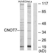 Western blot analysis of extracts from HUVEC cells and HeLa cells, using CNOT7 antibody.