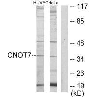Western blot analysis of extracts from HUVEC cells and HeLa cells, using CNOT7 antibody.