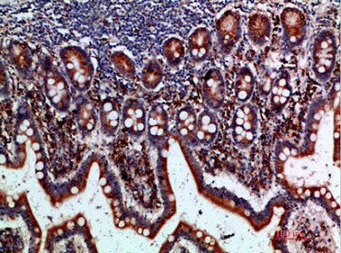 Immunohistochemical analysis of paraffin-embedded human-small-intestine, antibody was diluted at 1:200