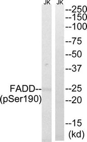 Western blot analysis of extracts from Jurkat cells treated with PMA using FADD (Phospho-Ser190) Antibody.The lane on the right is treated with the antigen-specific peptide.