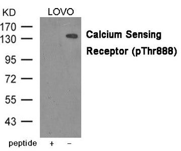 Western blot analysis of extracts from LOVO cells using Calcium Sensing Receptor (Phospho-Thr888) Antibody.The lane on the left is treated with the antigen-specific peptide.
