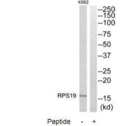Western blot analysis of extracts from K562 cells, using RPS19 antibody.