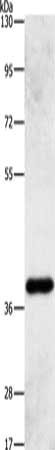 Gel: 8%SDS-PAGE, Lysate: 60 ug, Lane: Human fetal liver tissue, Primary antibody: CSB-PA446865(PRKAG1 Antibody) at dilution 1/500, Secondary antibody: Goat anti rabbit IgG at 1/8000 dilution, Exposure time: 5 minutes