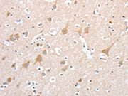 The image on the left is immunohistochemistry of paraffin-embedded Human brain tissue using CSB-PA447170(PCDHB16 Antibody) at dilution 1/30, on the right is treated with fusion protein. (Original magnification: ×200)