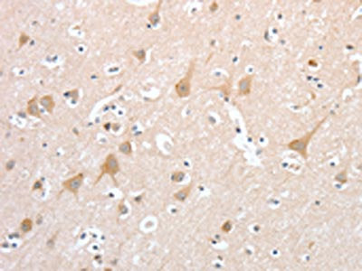 The image on the left is immunohistochemistry of paraffin-embedded Human brain tissue using CSB-PA447170(PCDHB16 Antibody) at dilution 1/30, on the right is treated with fusion protein. (Original magnification: ×200)