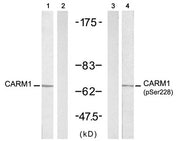 Western blot analysis of extracts from A431 cells untreated or treated with EGF (200ng/ml, 5min), using CARM1 (Ab-228) antibody (Line 1 and 2) and CARM1 (Phospho-Ser228) antibody (Line 3 and 4).