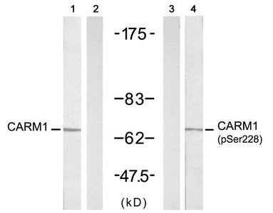 Western blot analysis of extracts from A431 cells untreated or treated with EGF (200ng/ml, 5min), using CARM1 (Ab-228) antibody (Line 1 and 2) and CARM1 (Phospho-Ser228) antibody (Line 3 and 4).