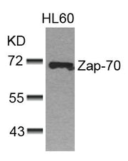 Western blot analysis of extracts from HL60 cells using Zap-70(Ab-493) Antibody.