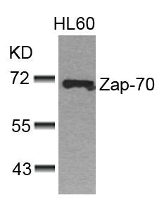Western blot analysis of extracts from HL60 cells using Zap-70(Ab-493) Antibody.