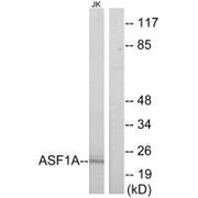 Western blot analysis of extracts from Jurkat cells, using ASF1A antibody.