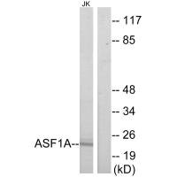 Western blot analysis of extracts from Jurkat cells, using ASF1A antibody.