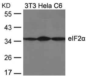 Western blot analysis of extracts from 3T3, Hela and C6 cells using eIF2a(Ab-51) Antibody.