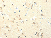 The image on the left is immunohistochemistry of paraffin-embedded Human brain tissue using CSB-PA447958(SYT5 Antibody) at dilution 1/20, on the right is treated with fusion protein. (Original magnification: ×200)