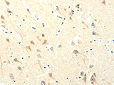 The image on the left is immunohistochemistry of paraffin-embedded Human brain tissue using CSB-PA447958(SYT5 Antibody) at dilution 1/20, on the right is treated with fusion protein. (Original magnification: ×200)